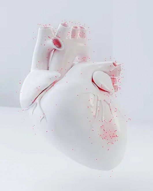 Cardisiography